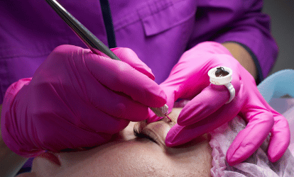 Мікроблейдинг брів