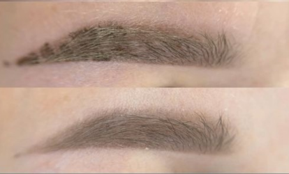 Загоєння після пудрового напилення